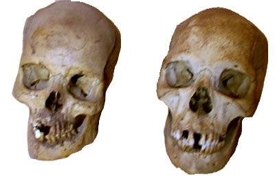 South Indian Skulls